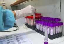 Bahia tem 15.628 casos ativos de Covid-19