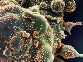 Brasil registra 394 mortes por covid-19 nas últimas 24 horas