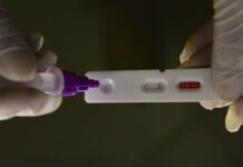 Brasil registra 27.796 casos e 114 mortes em 24 horas