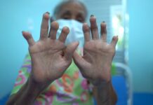 Campanha Janeiro Roxo luta contra preconceito referente à hanseníase