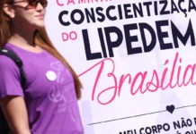 Lipedema: doença crônica vai além da questão estética Lipedema: doença crônica vai além da questão estética